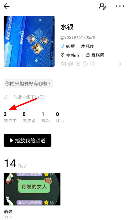 VUE添加关注的基础操作