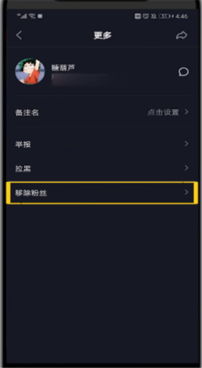 抖音中删除最近联系人的简单教程