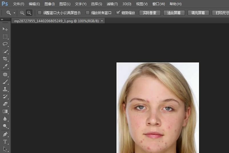 我来分享教你用PS消除脸上痘痘。