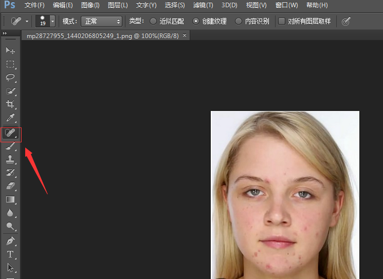 我来分享教你用PS消除脸上痘痘。