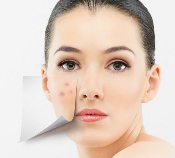 美图秀秀怎么祛疤,美图秀秀去除照片上痘痘疤痕教程