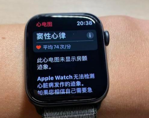 applewatch心电图怎么用?苹果手表国行心电图开启教程