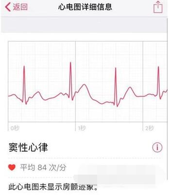 AppleWatch7怎么查看心电图数据？AppleWatch7心电图数据查看方法