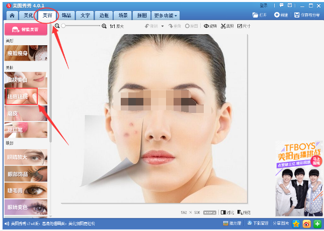 美图秀秀去除照片上痘痘疤痕的操作教程