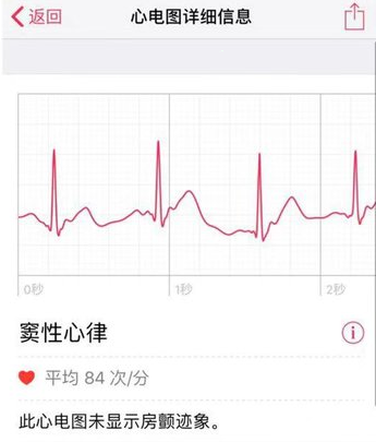 Apple Watch怎样查看心电图?Apple Watch查看心电图的方法步骤