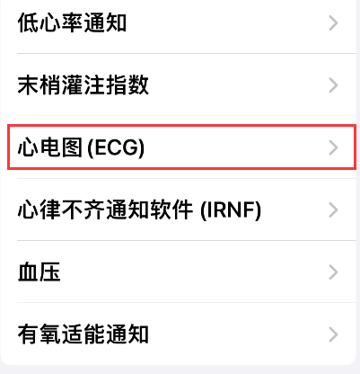 Apple Watch怎样查看心电图?Apple Watch查看心电图的方法步骤